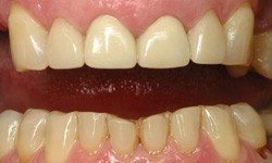 Healthy smile after dental treatment