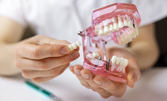 Dentist using model to discuss dental implant tooth replacement