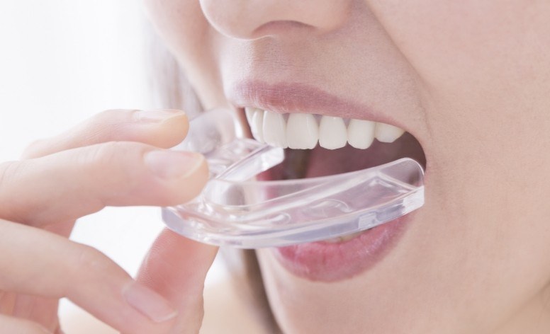 Dental patient placing a mouthguard for teeth grinding