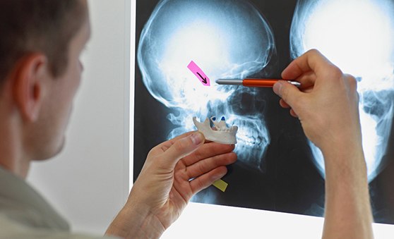 A dentist looking at an X-ray of TMJ joints