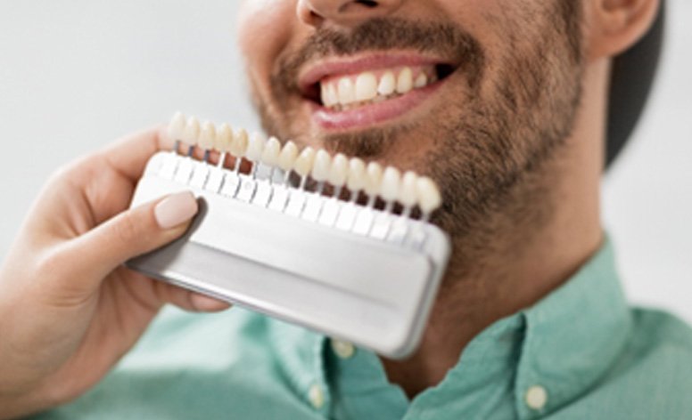 Patient smiling while dentist determines perfect shade of porcelain