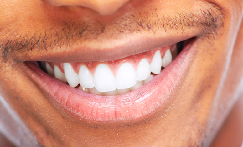Closeup of a man smiling
