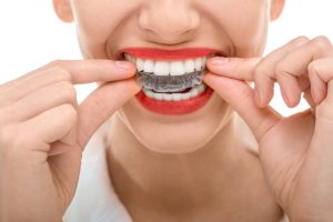 Invisalign in Fort Worth straighten smiles quickly and discreetly. Learn about these innovative aligners from the experts at Fort Dental.