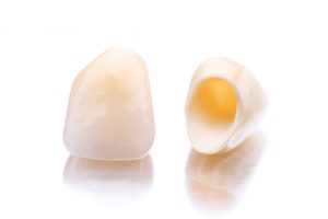 two dental crowns