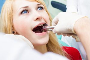 girl getting a tooth extraction