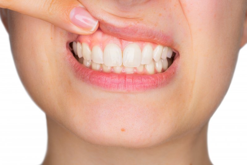 person showing teeth in Fort Worth